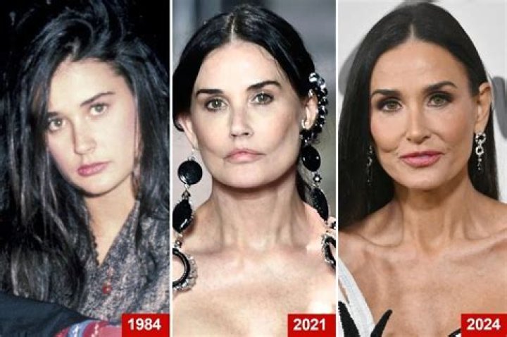 demi moore plastic surgery