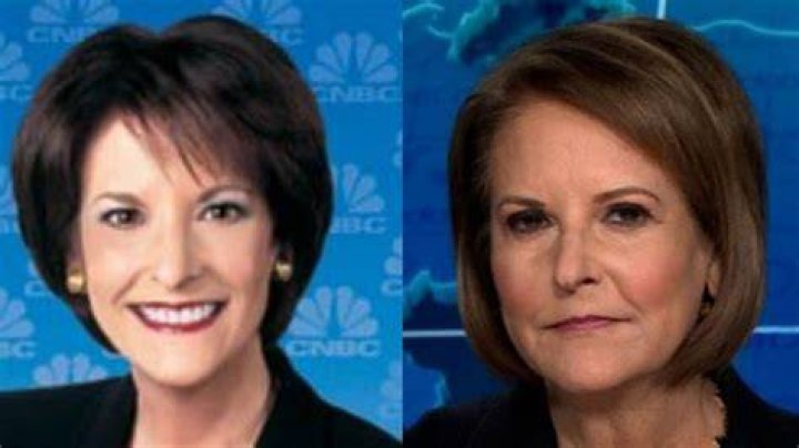 Gloria Borger plastic surgery