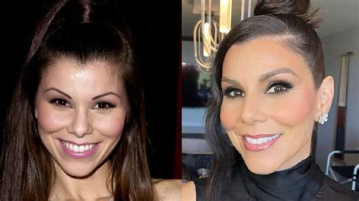Heather Dubrow’s Plastic Surgery!