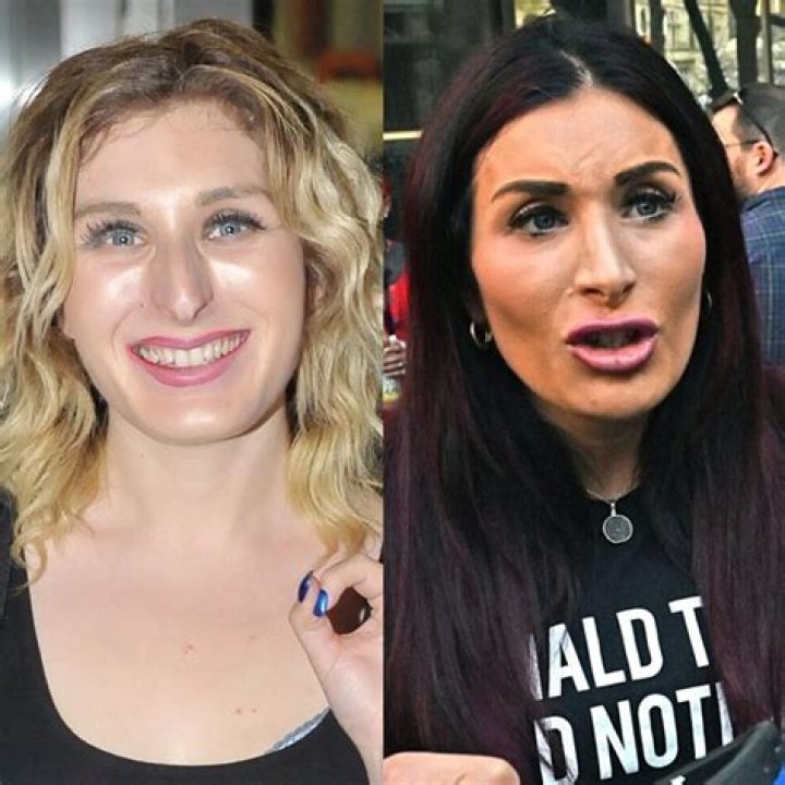 Laura Loomer Plastic Surgery